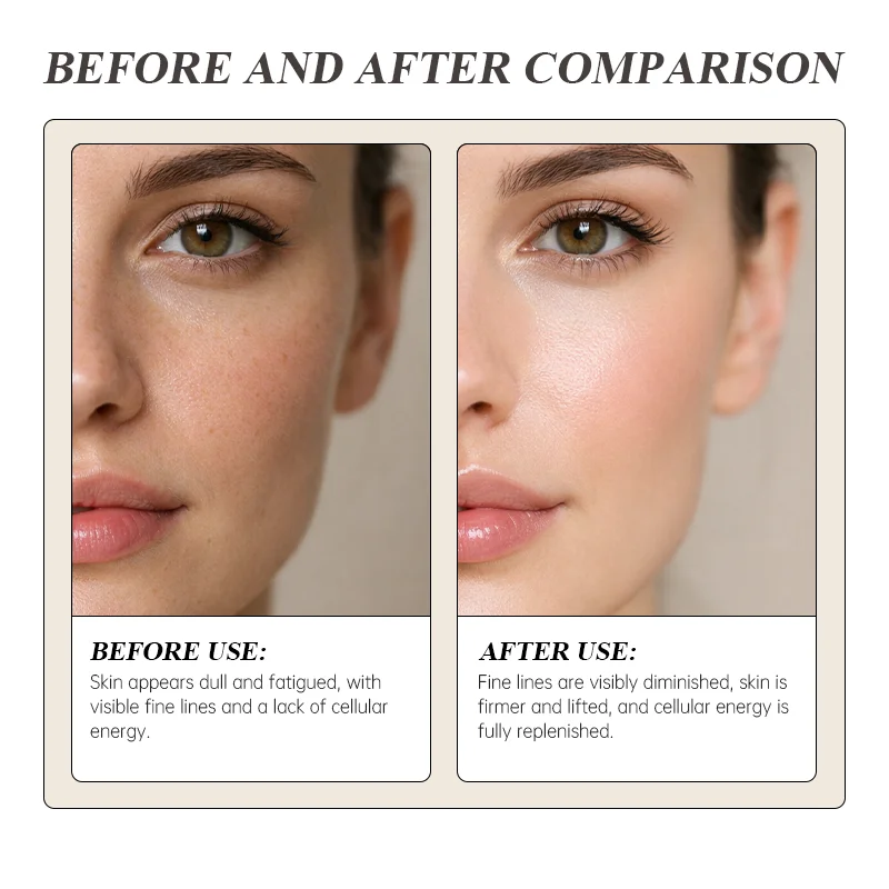 Side-by-side before and after skincare comparison showing improved skin texture, reduced fine lines, and enhanced brightness.